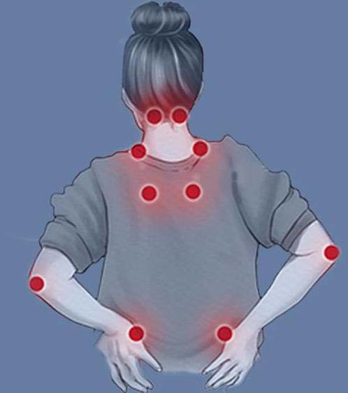 Fibromyalgia-