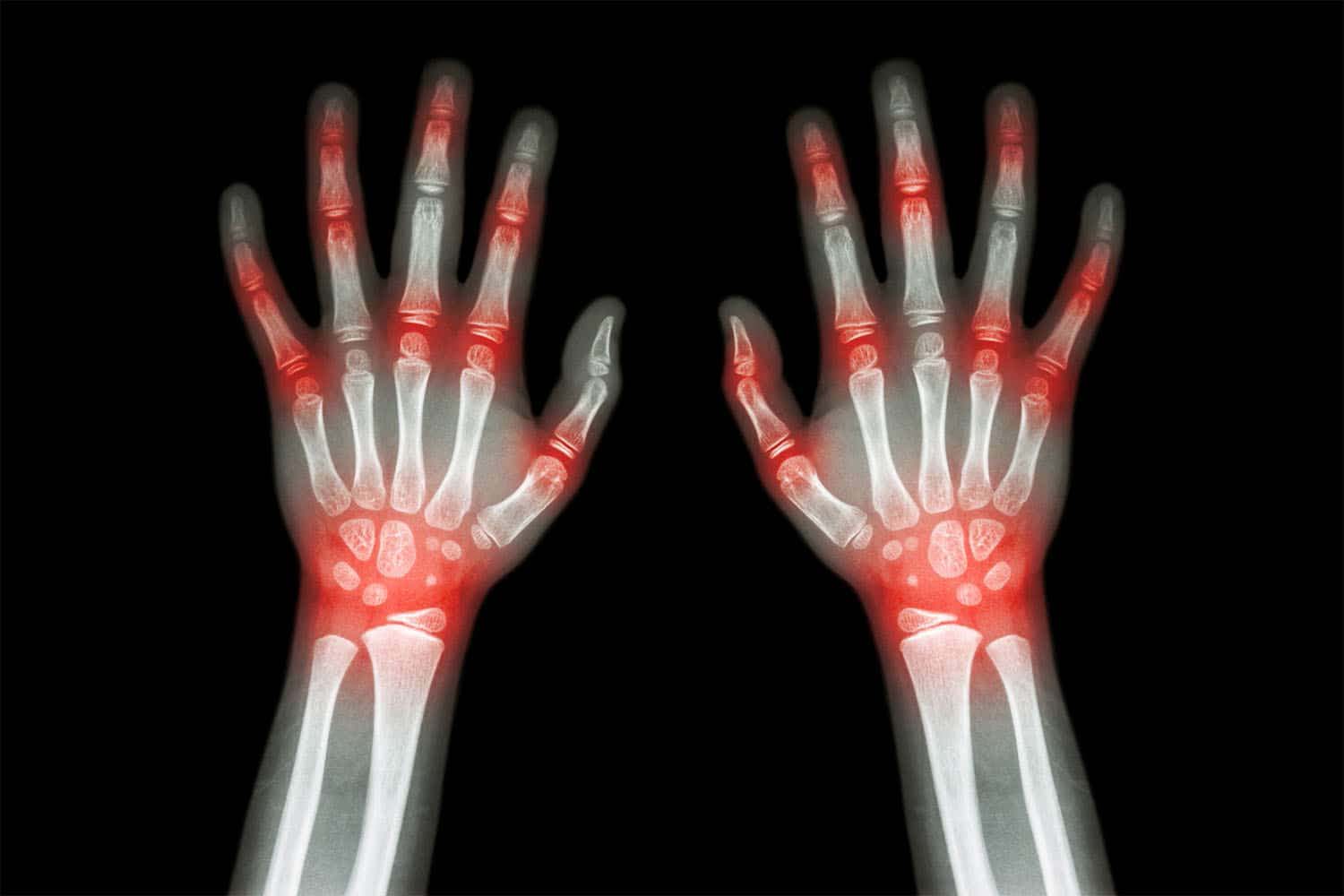 hand-joint-pain-