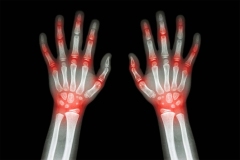 hand-joint-pain-